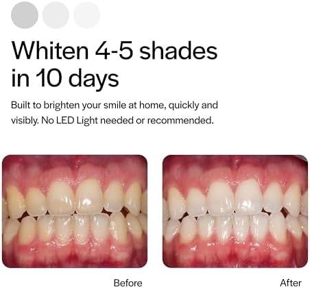 Opalescence Go 15% Mint - Prefilled Teeth Whitening Trays - 15% Hydrogen Peroxide - (10 Treatments) Made by Ultradent Products. Teeth Whitening Kit -Mint - Includes 2Chill Toothbrush 5194-1T
