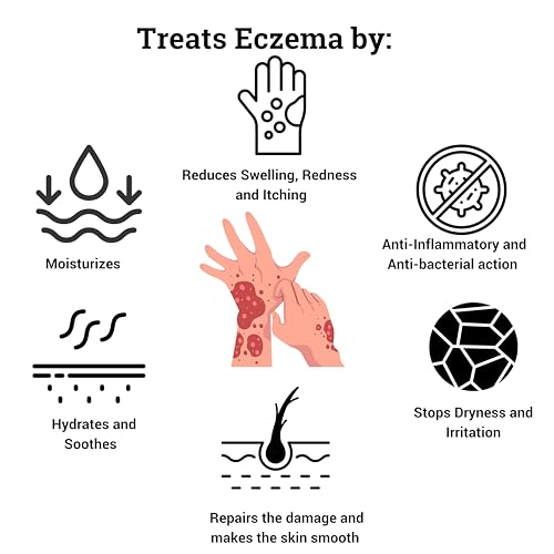 The Soap for Eczema Therapy. Hand Made from Natural Ingredients Only. Dye and Fragrance Free. (3 pack)