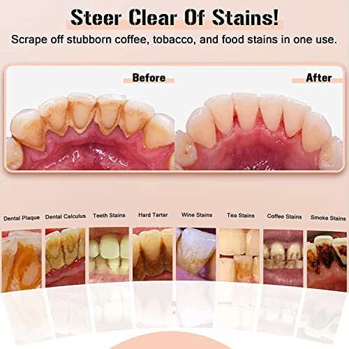 Plaque Remover for Teeth, Electric Tooth Cleaner Tartar Remover for Teeth with LED Light,4 Modes Rechargeable Teeth Cleaning Kit with Dental Tools, 2 Replaceable Heads (White A)