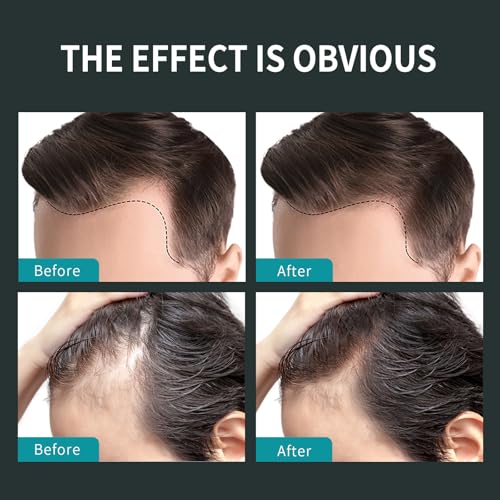 SEVICH Hair Fiber Thickener Spray - Instant Hair Thickening Powder for Men & Women, Root Touch Up Hair Color, Hair Building Fibers for Thinning Hair, Waterproof, Sweatproof, Natural Look,120ml Black