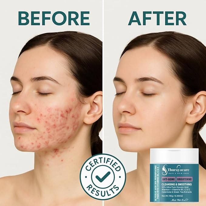 Glycolic Acid 20% Exfoliating Pads – Anti-Aging Face Pads with Vitamins B5, C, E, Allantoin & Niacinamide – Resurfacing, Brightening & Pore Cleansing – 100 Count